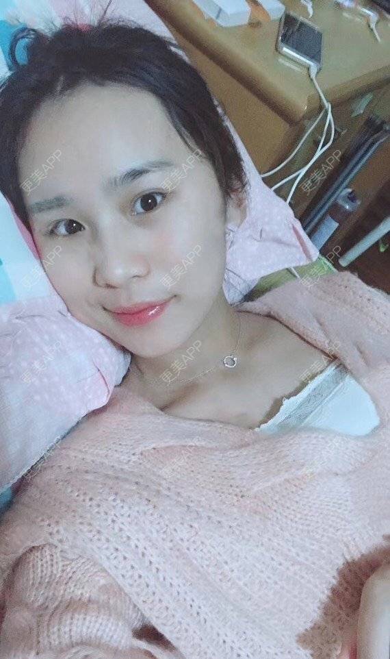 更美 - 宝儿姐😄的全瓷牙经验 | 全瓷牙 | 合金烤瓷牙 | 二氧化锆烤瓷牙