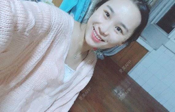 更美 - 宝儿姐😄的全瓷牙经验 | 全瓷牙 | 合金烤瓷牙 | 二氧化锆烤瓷牙
