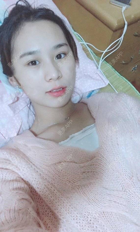 更美 - 宝儿姐😄的全瓷牙经验 | 全瓷牙 | 合金烤瓷牙 | 二氧化锆烤瓷牙