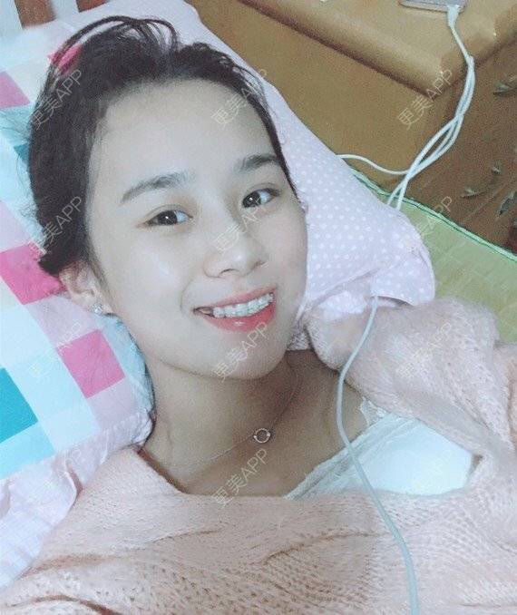 更美 - 宝儿姐😄的全瓷牙经验 | 全瓷牙 | 合金烤瓷牙 | 二氧化锆烤瓷牙