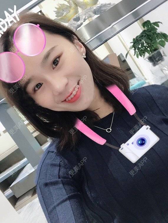 更美 - 宝儿姐😄的全瓷牙经验 | 全瓷牙 | 合金烤瓷牙 | 二氧化锆烤瓷牙