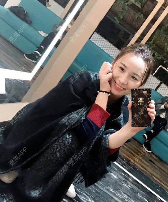 更美 - 宝儿姐😄的全瓷牙经验 | 全瓷牙 | 合金烤瓷牙 | 二氧化锆烤瓷牙