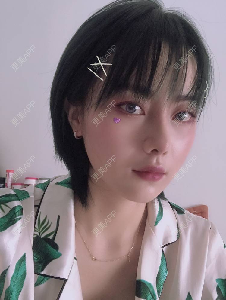 更美 - 更美用户R8DRI4045X的鼻部多项经验 | 成都 | 鼻部多项