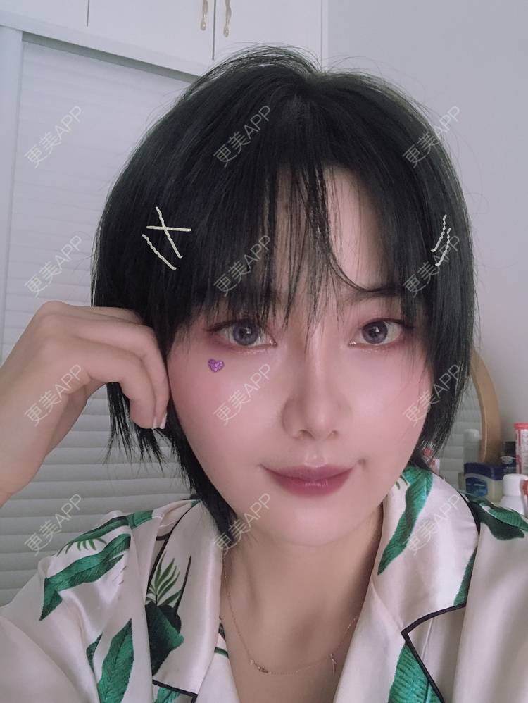 更美 - 更美用户R8DRI4045X的鼻部多项经验 | 成都 | 鼻部多项