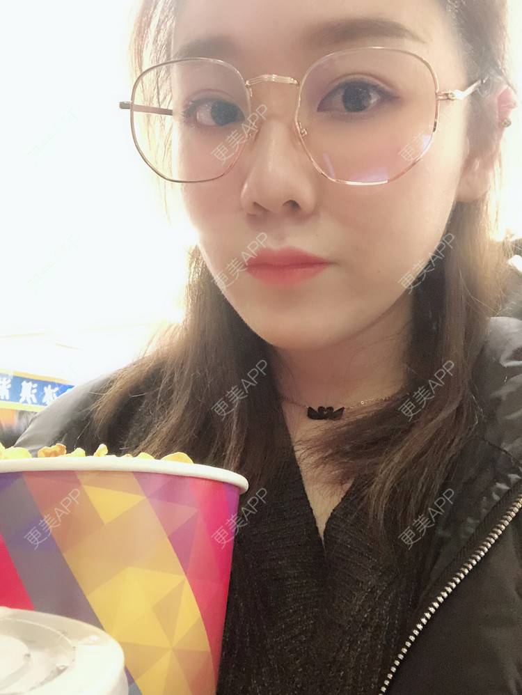 更美 - 更美用户dzhtMneR9R的像素激光经验 | 像素激光 | 红蓝光清痘 | 果酸焕肤