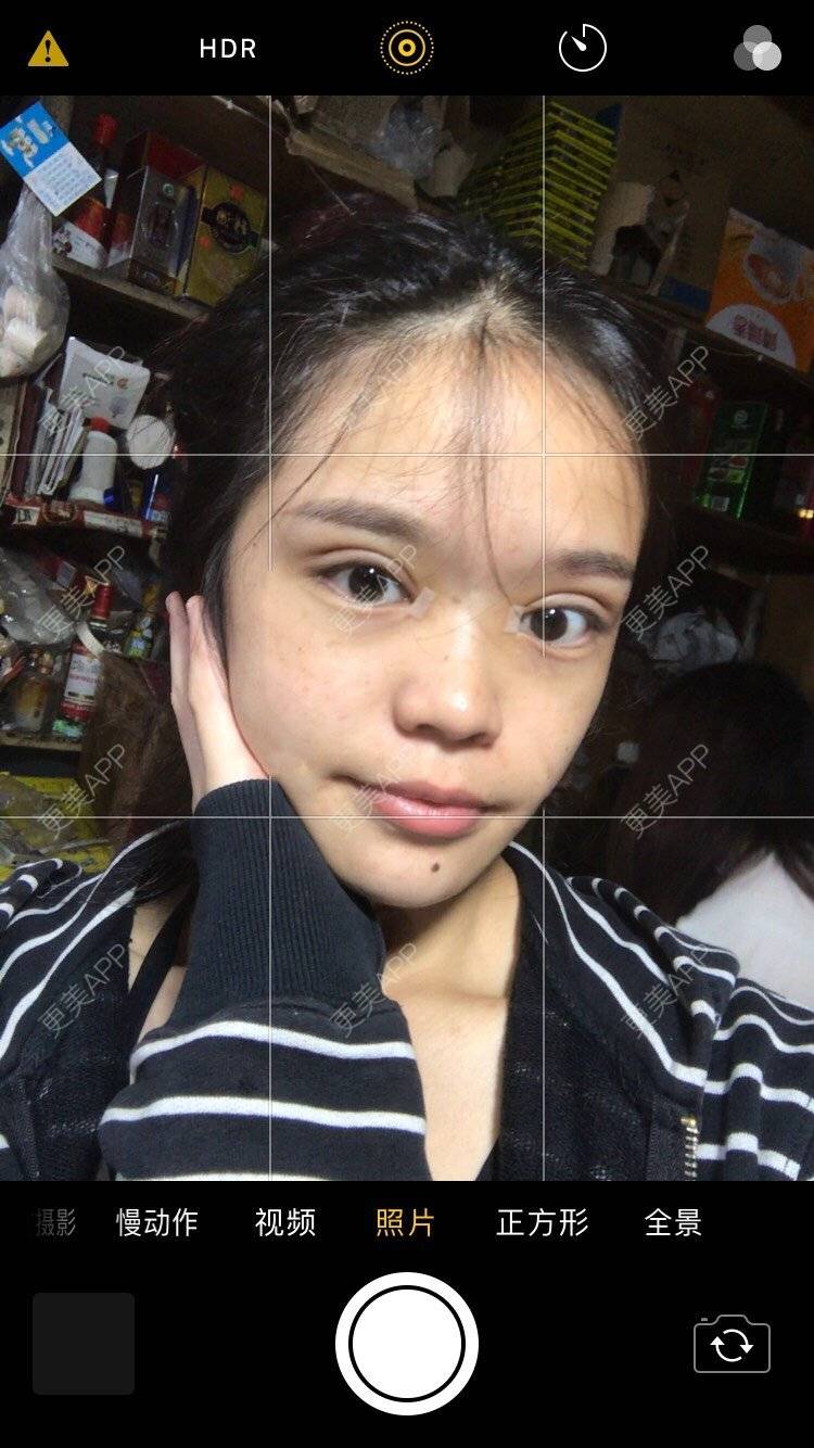 更美 - 更美用户pw2FXbUb8o的全切双眼皮经验 | 全切双眼皮 | 开内眼角 | 贵阳 | 眼部多项