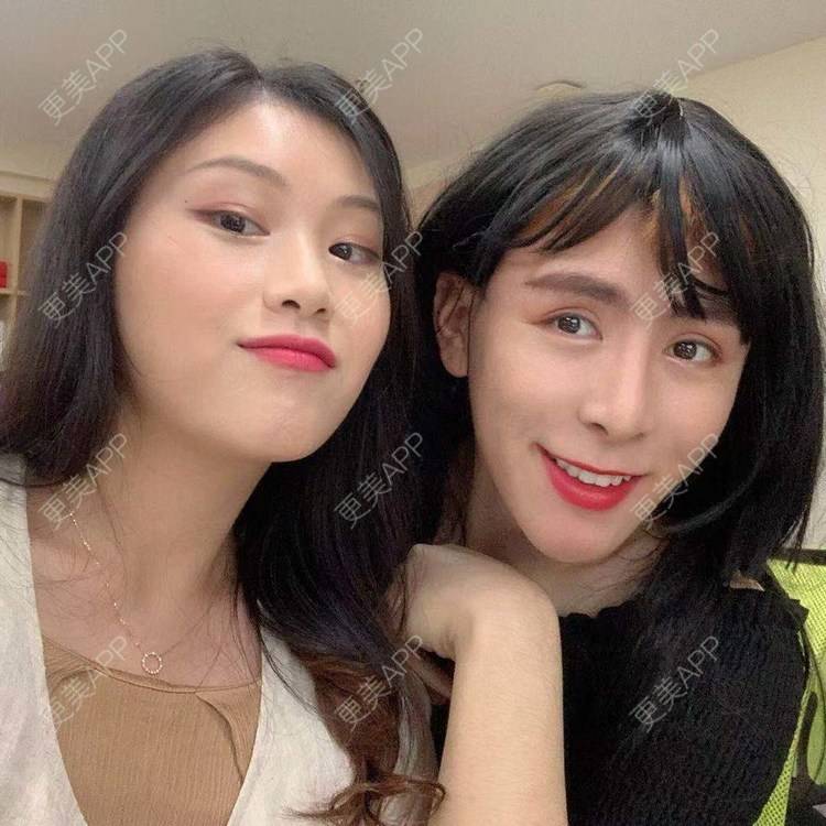 更美 - 陈温柔~的膨体垫眉弓经验 | 膨体垫眉弓 | 视频日记 | 重庆