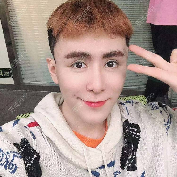 更美 - 陈温柔~的膨体垫眉弓经验 | 膨体垫眉弓 | 视频日记 | 重庆