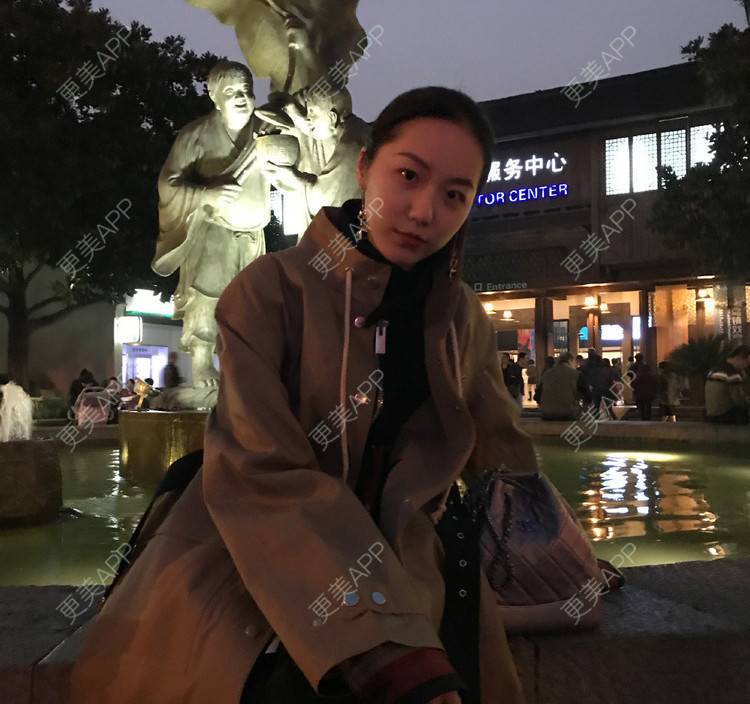 更美 - 扬扬AD的树脂补牙经验 | 树脂补牙