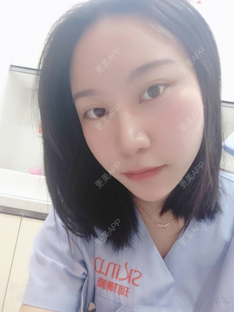 更美 - 更美用户QwczJNGlYL的鼻部多项经验 | 鼻部多项 | 鼻中隔软骨垫鼻头 | 自体软骨垫鼻尖 | 鼻小柱缩短 | 手术缩鼻头 | 鼻部综合