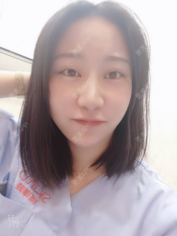 更美 - 更美用户QwczJNGlYL的鼻部多项经验 | 鼻部多项 | 鼻中隔软骨垫鼻头 | 自体软骨垫鼻尖 | 鼻小柱缩短 | 手术缩鼻头 | 鼻部综合