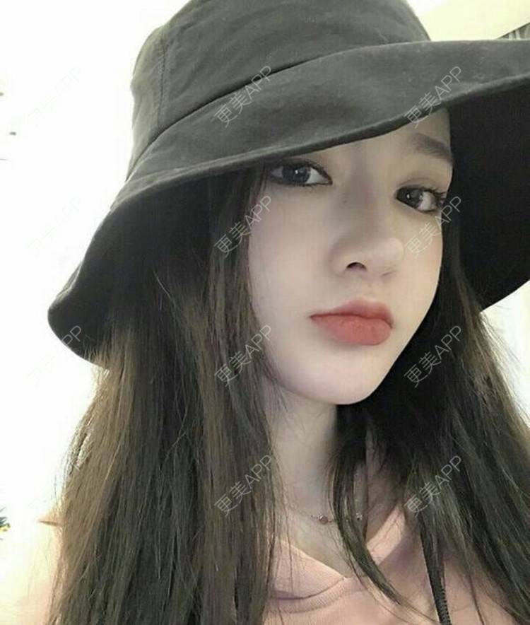 更美 - 那個MM硪愛你岗的激光脱腋毛经验 | 激光脱腋毛 | 北京