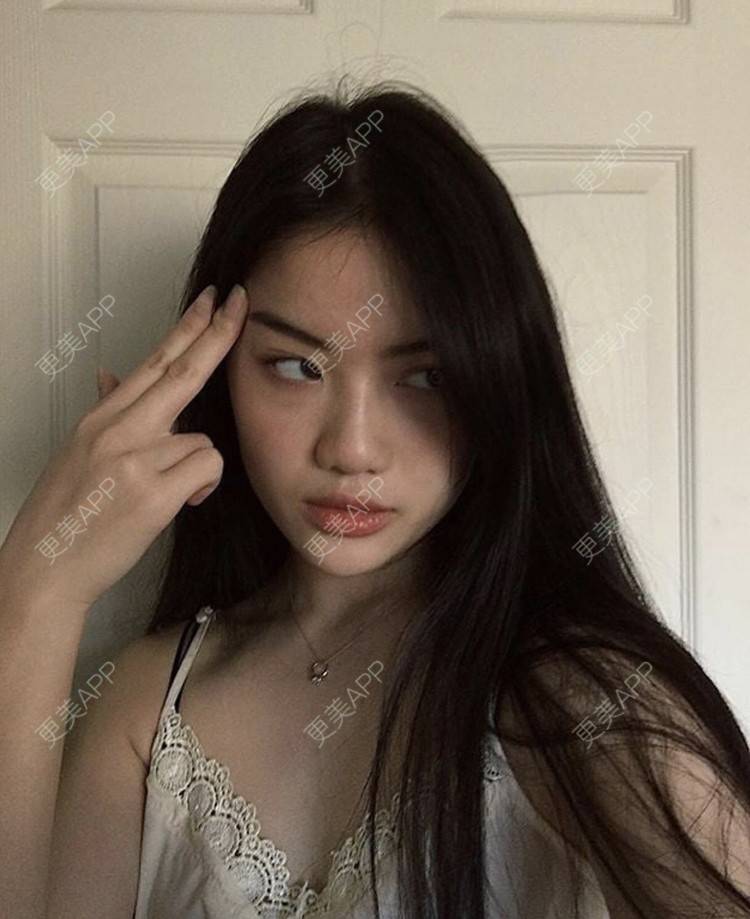 更美 - 那個MM硪愛你岗的激光脱腋毛经验 | 激光脱腋毛 | 北京