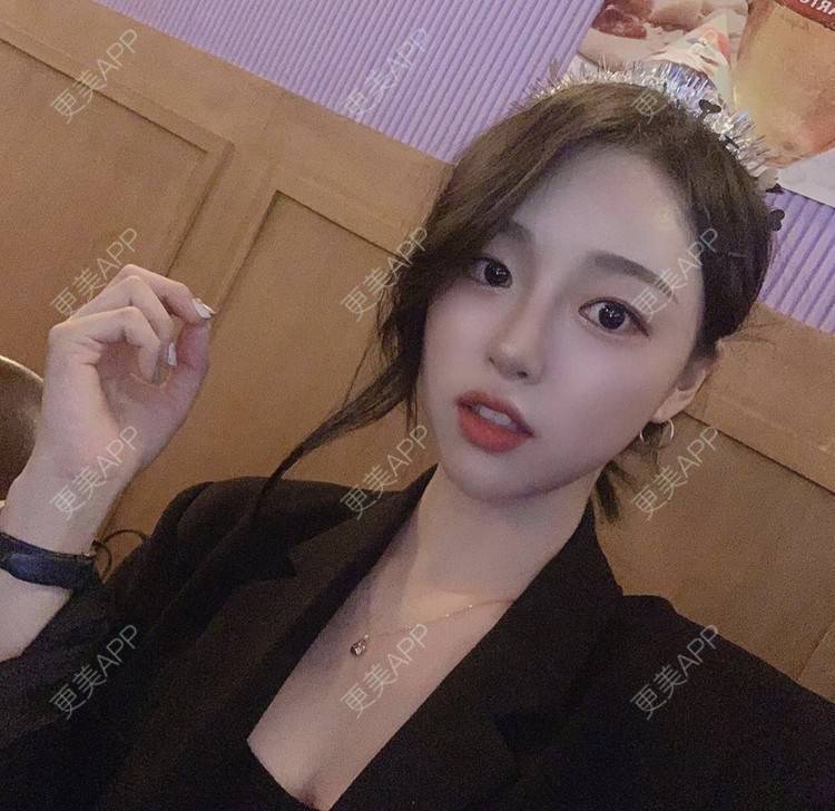 更美 - ↓奮鬥不息的夢想↑仲的激光脱腋毛经验 | 激光脱腋毛 | 北京