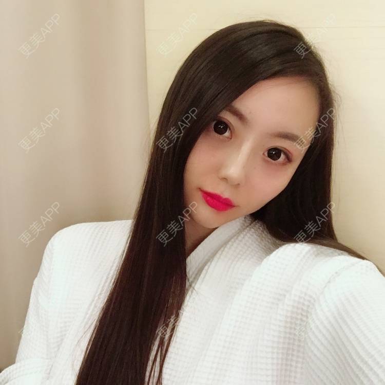 更美 - 更美用户QhDs9RVr2A的玻尿酸面部细纹经验 | 上海 | 玻尿酸面部细纹