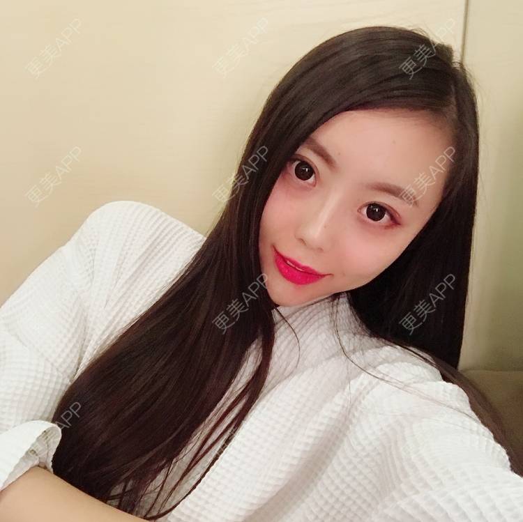 更美 - 更美用户QhDs9RVr2A的玻尿酸面部细纹经验 | 上海 | 玻尿酸面部细纹