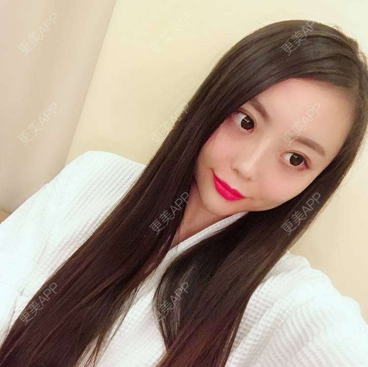 更美 - 更美用户QhDs9RVr2A的玻尿酸面部细纹经验 | 上海 | 玻尿酸面部细纹