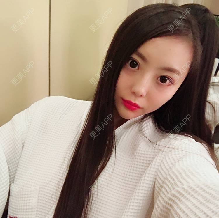 更美 - 更美用户QhDs9RVr2A的玻尿酸面部细纹经验 | 上海 | 玻尿酸面部细纹