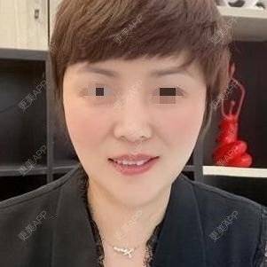 更美 - 更美用户o9647lu9Ax的激光淡斑经验 | 激光淡斑 | 深圳
