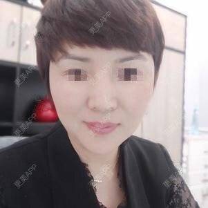 更美 - 更美用户o9647lu9Ax的激光淡斑经验 | 激光淡斑 | 深圳
