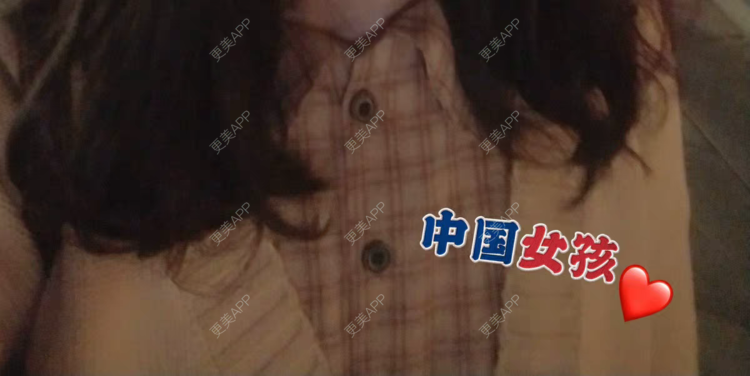 更美 - 可乐加冰淇淋的激光脱腋毛经验 | 上海 | 激光脱腋毛