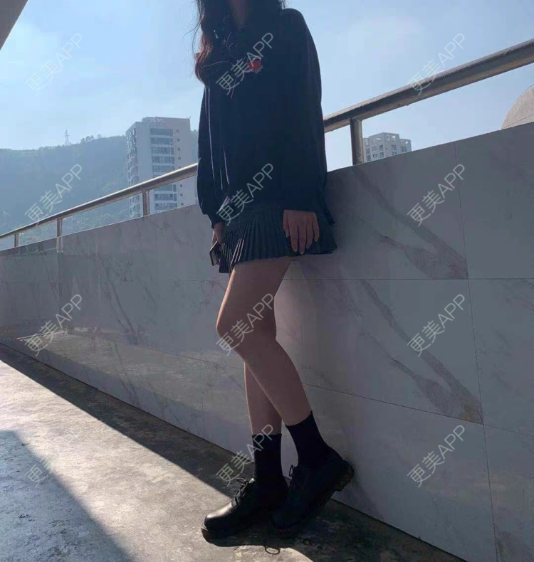 更美 - 可乐加冰淇淋的激光脱腋毛经验 | 上海 | 激光脱腋毛