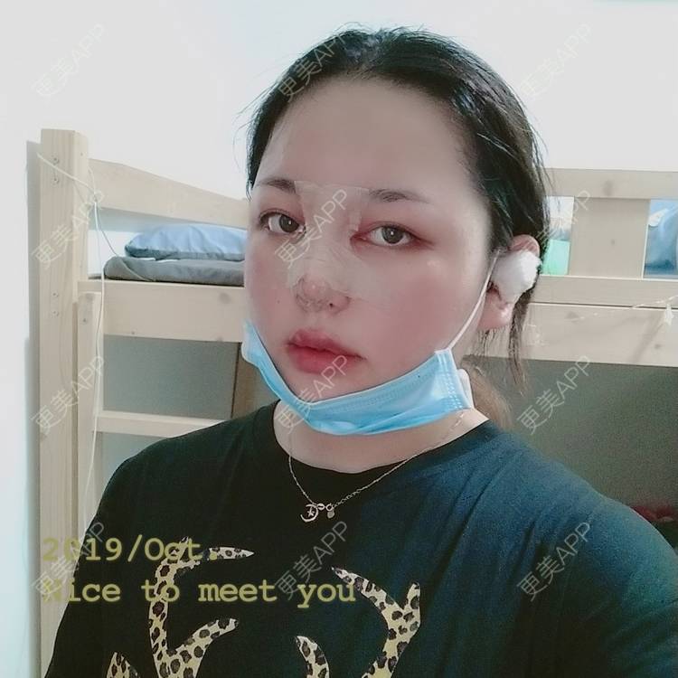更美 - Shymi ツ的鼻部多项经验 | 鼻部多项 | 广州