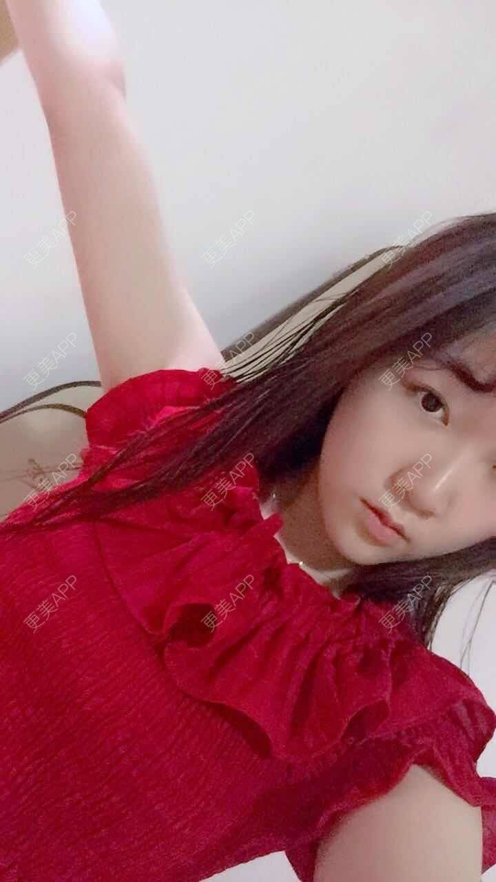 更美 - 阳光灿烂的微笑的背部吸脂经验 | 背部吸脂 | 武汉