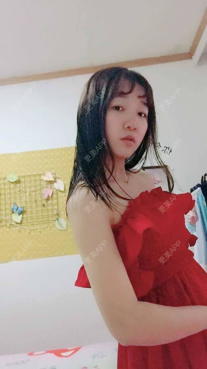 更美 - 阳光灿烂的微笑的背部吸脂经验 | 背部吸脂 | 武汉