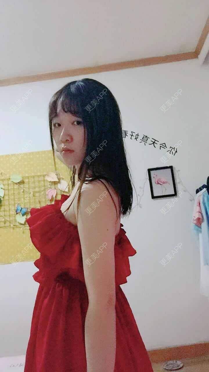 更美 - 阳光灿烂的微笑的背部吸脂经验 | 背部吸脂 | 武汉
