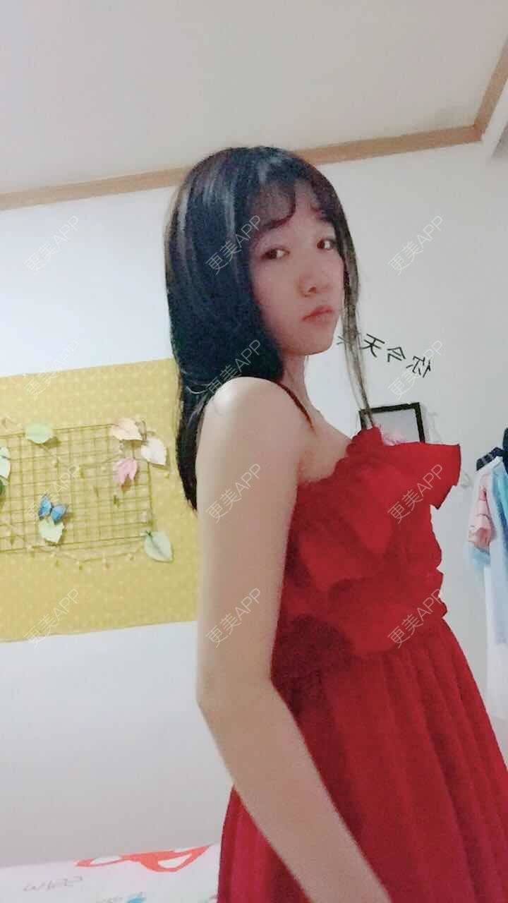 更美 - 阳光灿烂的微笑的背部吸脂经验 | 背部吸脂 | 武汉