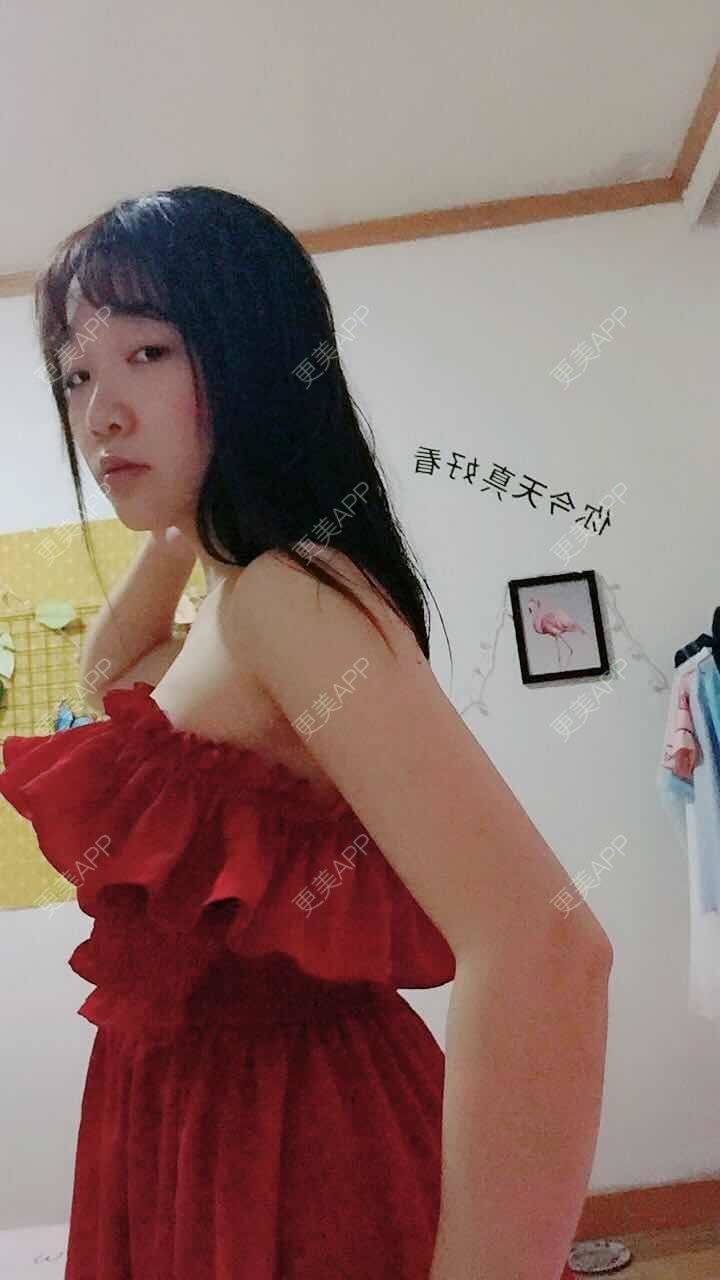 更美 - 阳光灿烂的微笑的背部吸脂经验 | 背部吸脂 | 武汉
