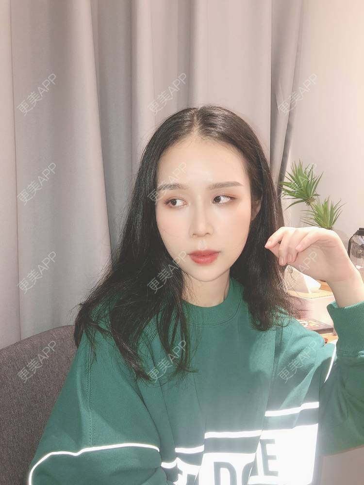 更美 - 超级超级好吃的下巴经验 | 膨体垫下巴 | 硅胶垫下巴 | 缩下巴 | 宽下巴矫正 | 人工骨垫下巴 | 玻尿酸下巴 | 自体脂肪垫下巴 | 胶原蛋白丰下巴