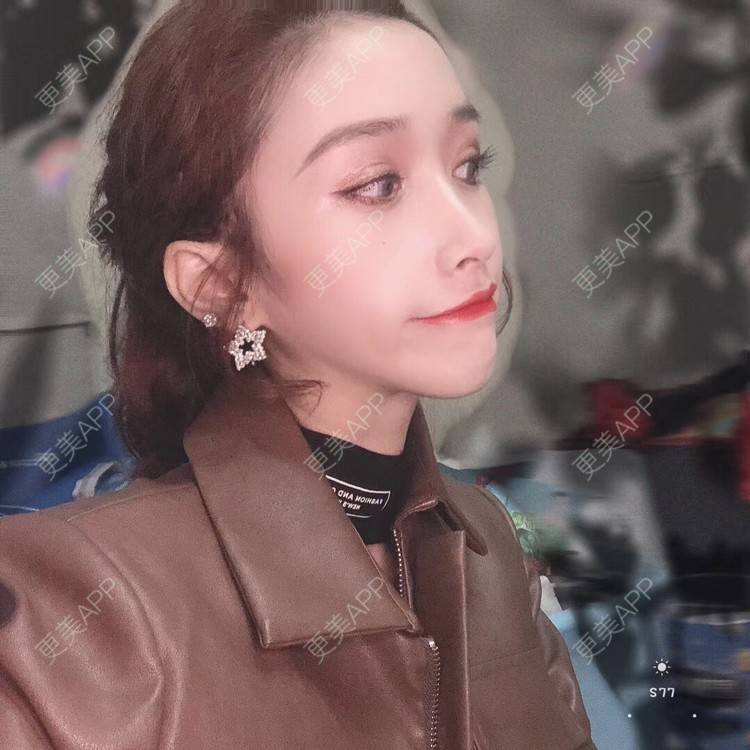 更美 - 丢了灵魂的孩纸的唇腭裂修复经验 | 厚唇改薄 | 唇腭裂修复 | 玻尿酸唇部 | 自体脂肪丰唇 | 胶原蛋白丰唇