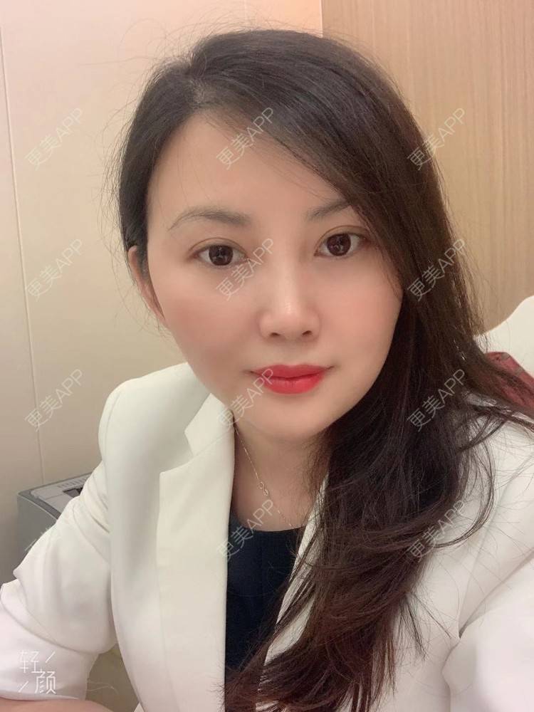 更美 - 潇潇风雨☔️的玻尿酸套餐经验 | 玻尿酸套餐 | 视频日记 | 广州