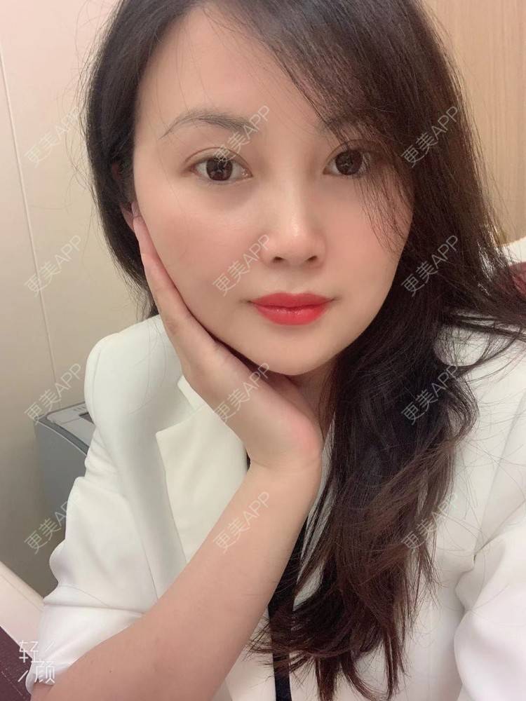 更美 - 潇潇风雨☔️的玻尿酸套餐经验 | 玻尿酸套餐 | 视频日记 | 广州