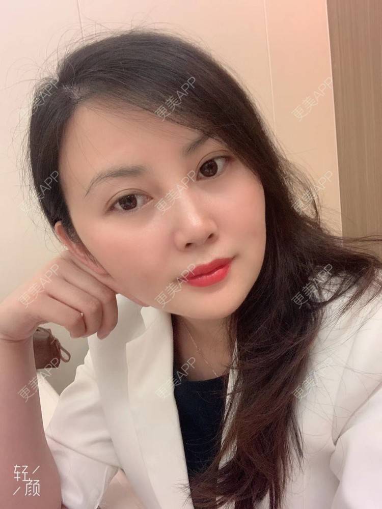 更美 - 潇潇风雨☔️的玻尿酸套餐经验 | 玻尿酸套餐 | 视频日记 | 广州