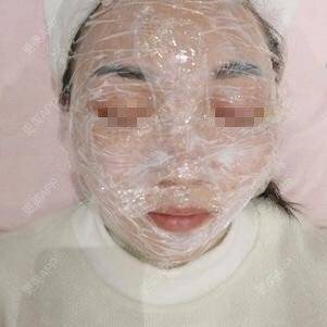 更美 - 更美用户lxD5uA89cw的激光淡斑经验 | 激光淡斑 | 皮秒激光 | 深圳