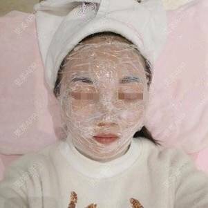 更美 - 更美用户lxD5uA89cw的激光淡斑经验 | 激光淡斑 | 皮秒激光 | 深圳