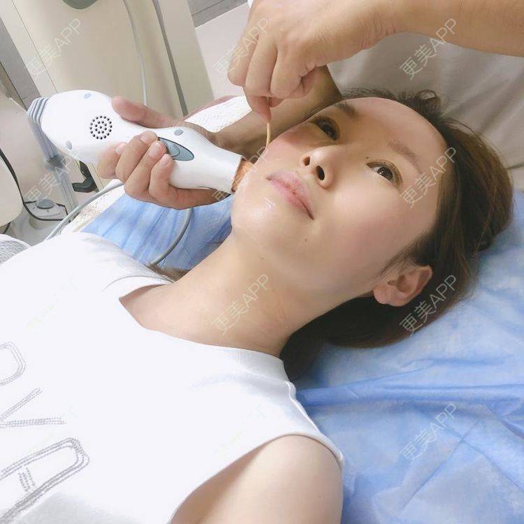 更美 - 大连维恩柏颜医疗美容门诊部的热玛吉经验 | 热玛吉