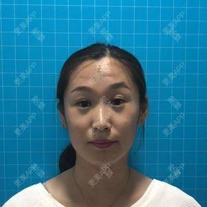 更美 - 大连维恩柏颜医疗美容门诊部的热玛吉经验 | 热玛吉