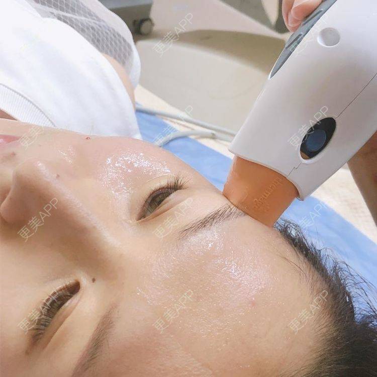 更美 - 大连维恩柏颜医疗美容门诊部的热玛吉经验 | 热玛吉