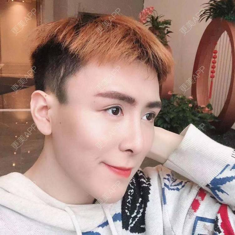 更美 - 陈温柔~的膨体垫眉弓经验 | 膨体垫眉弓 | 视频日记 | 重庆