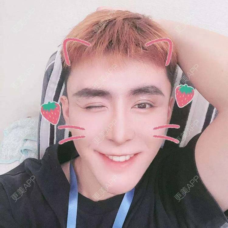 更美 - 陈温柔~的膨体垫眉弓经验 | 膨体垫眉弓 | 视频日记 | 重庆