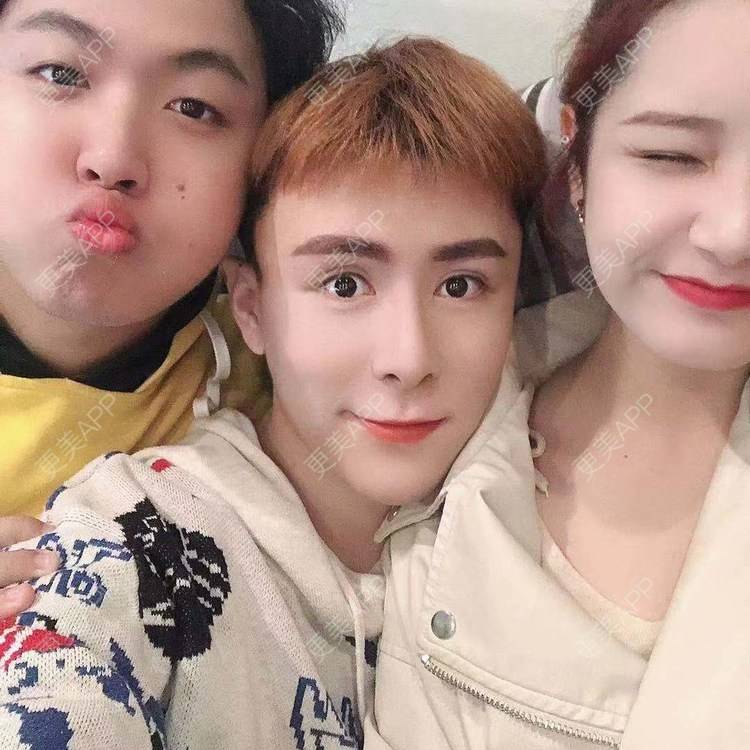 更美 - 陈温柔~的膨体垫眉弓经验 | 膨体垫眉弓 | 视频日记 | 重庆