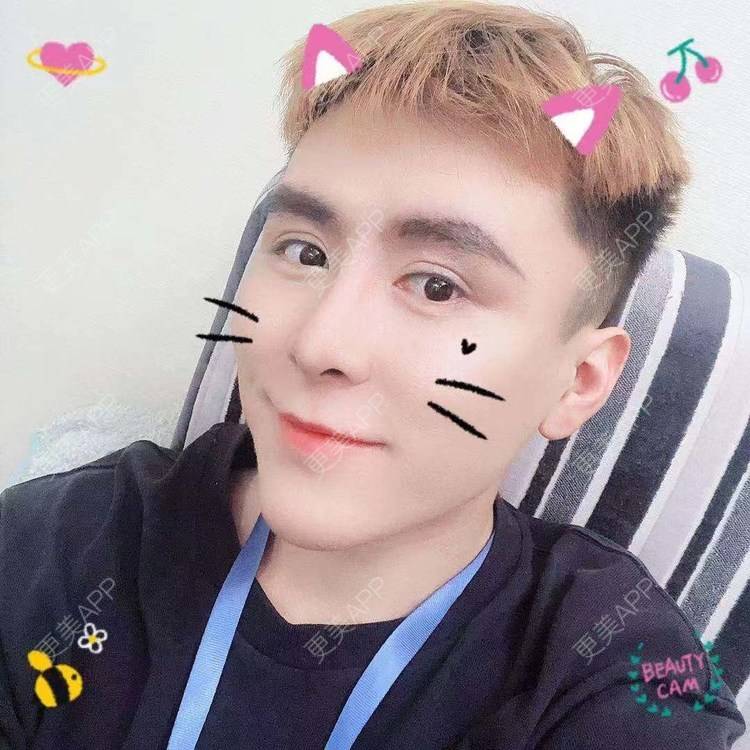 更美 - 陈温柔~的膨体垫眉弓经验 | 膨体垫眉弓 | 视频日记 | 重庆