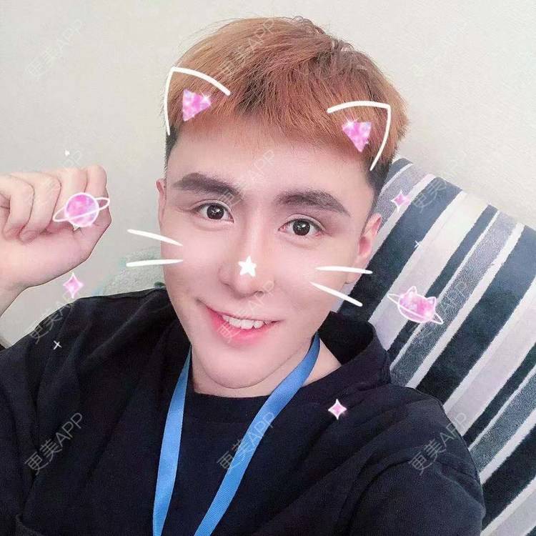 更美 - 陈温柔~的膨体垫眉弓经验 | 膨体垫眉弓 | 视频日记 | 重庆