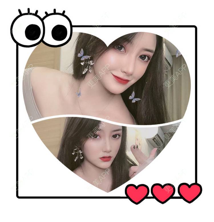 更美 - 小晴晴宝宝的眼皮下垂矫正经验 | 广州 | 眼皮下垂矫正
