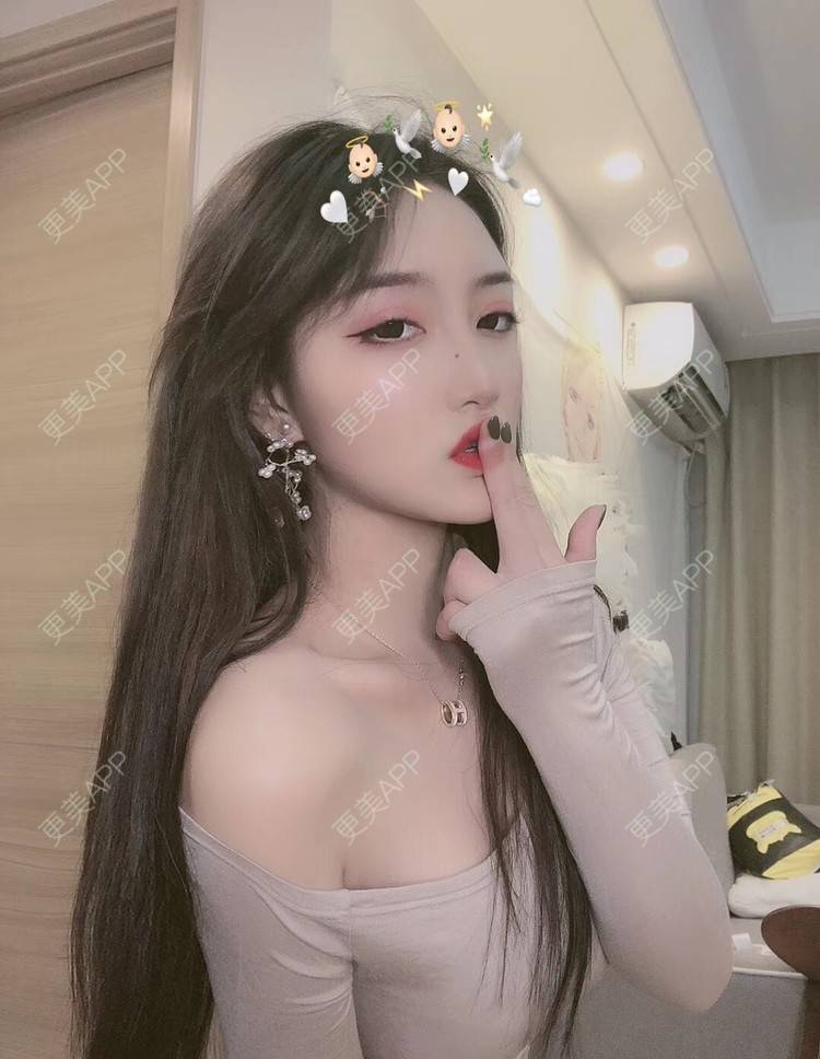 更美 - 小晴晴宝宝的眼皮下垂矫正经验 | 广州 | 眼皮下垂矫正