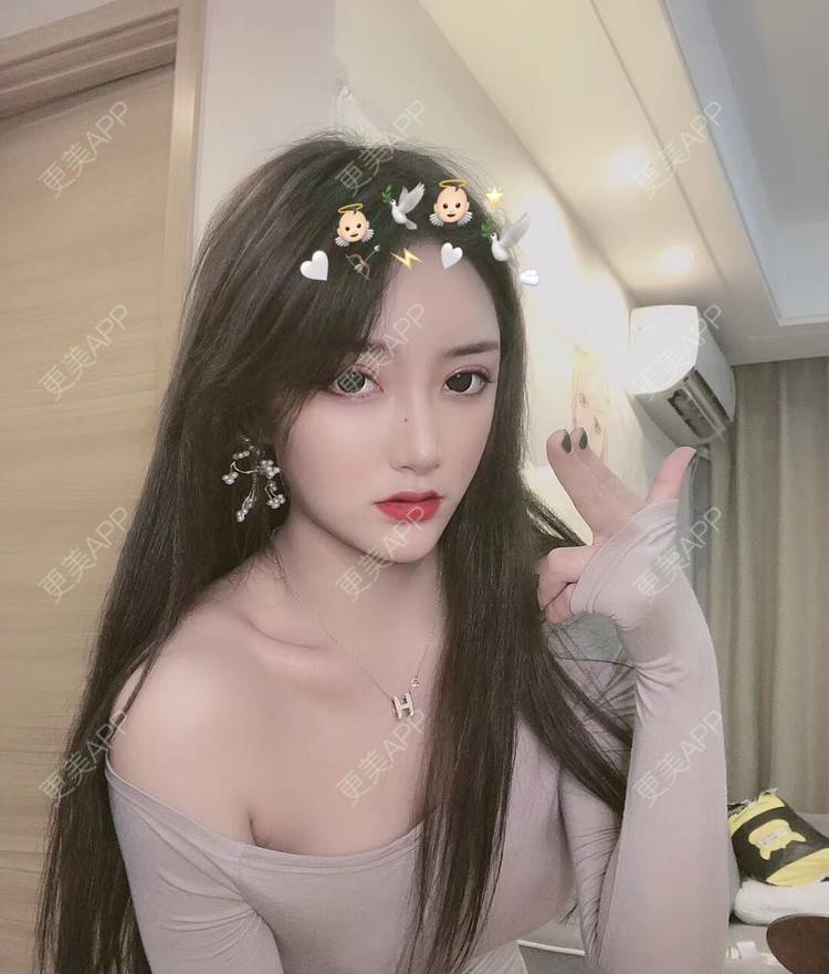 更美 - 小晴晴宝宝的眼皮下垂矫正经验 | 广州 | 眼皮下垂矫正